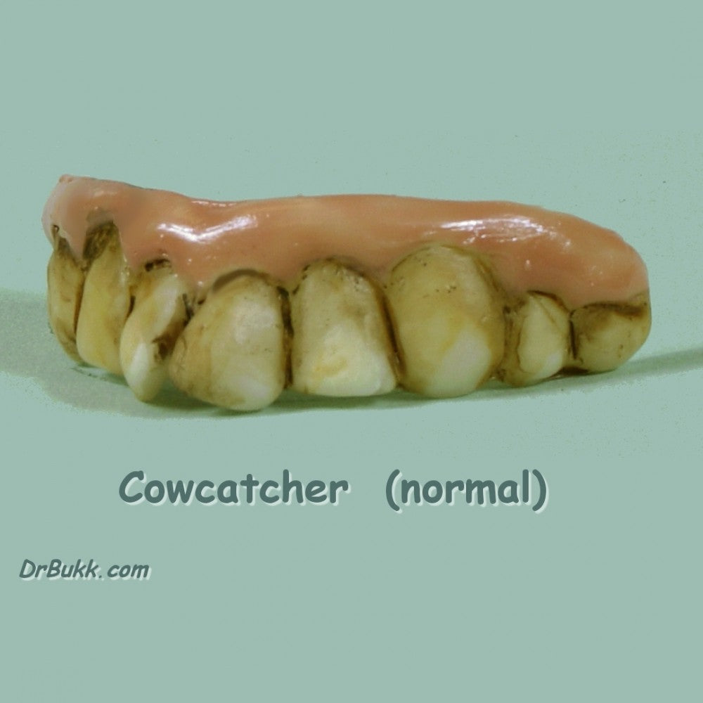 Cowcatcher Teeth