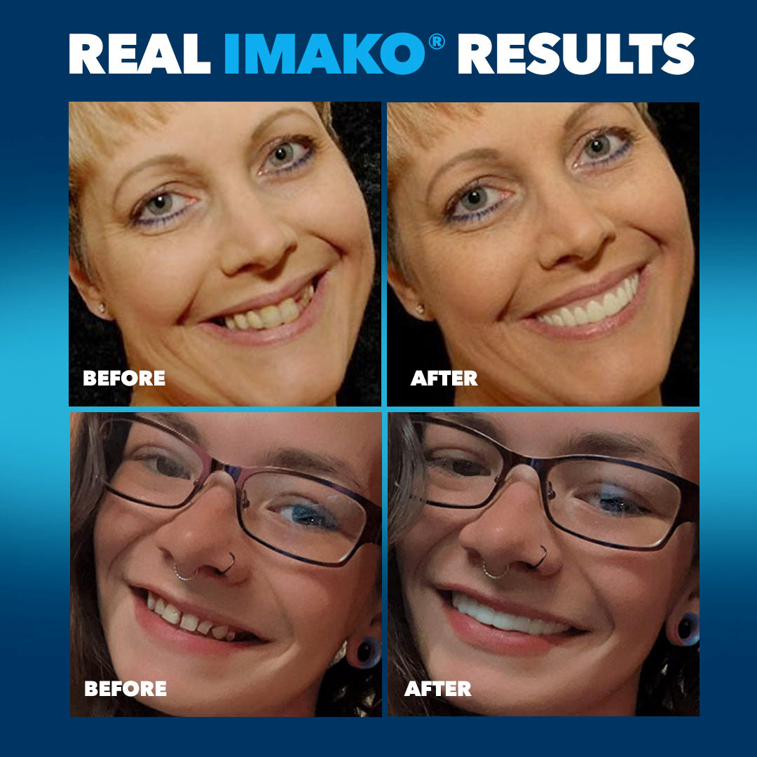 Imako® Perfect Smile